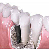 ʲô��Ӣʽ��ʹ��ֲ����